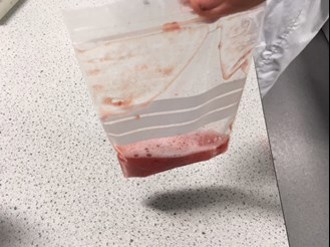red liquid in a bag